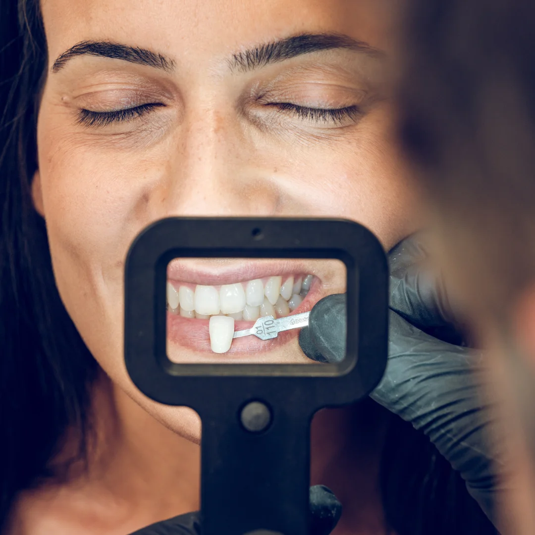 estetica-dental estetica-dental