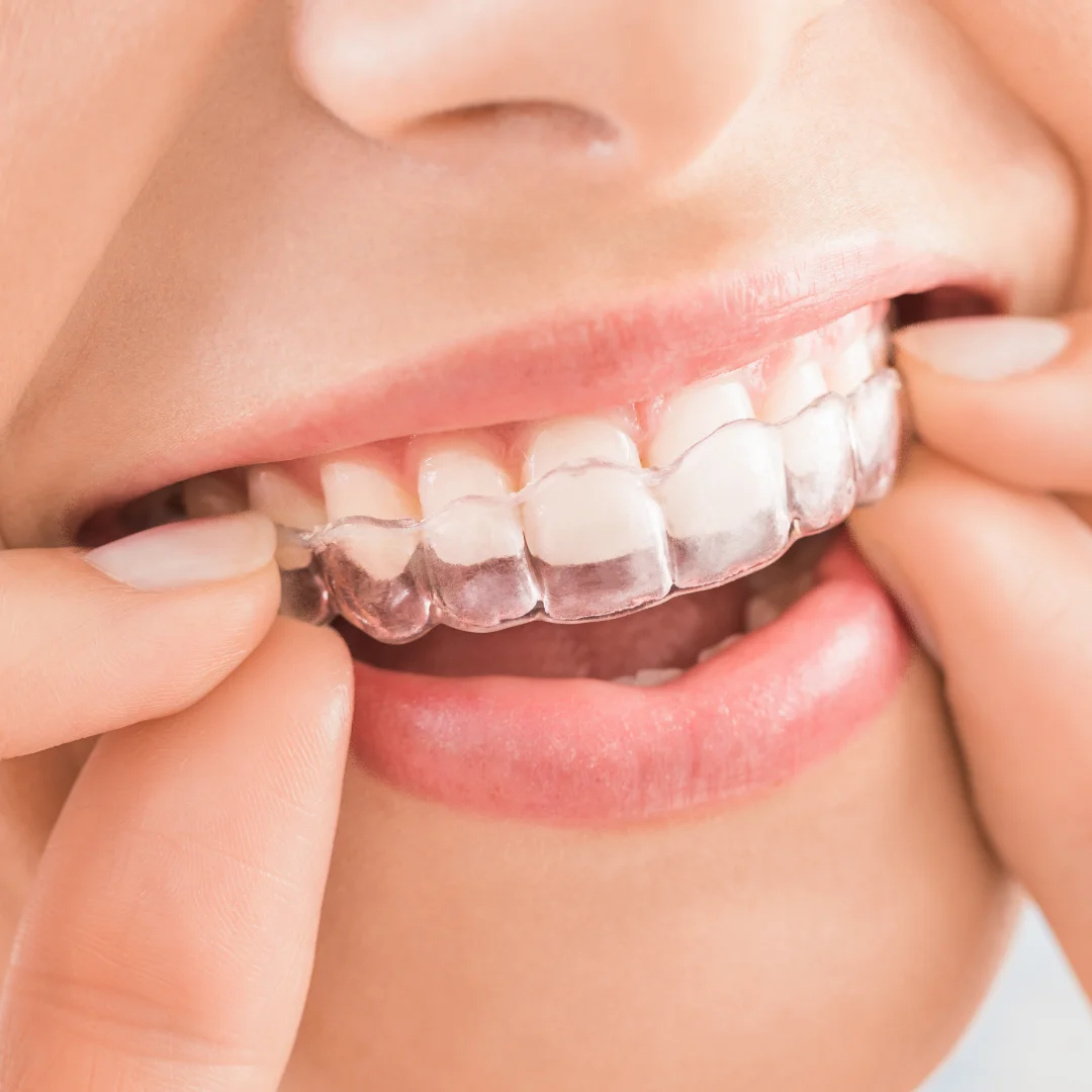 ortodoncia-en-caba ortodoncia en caba